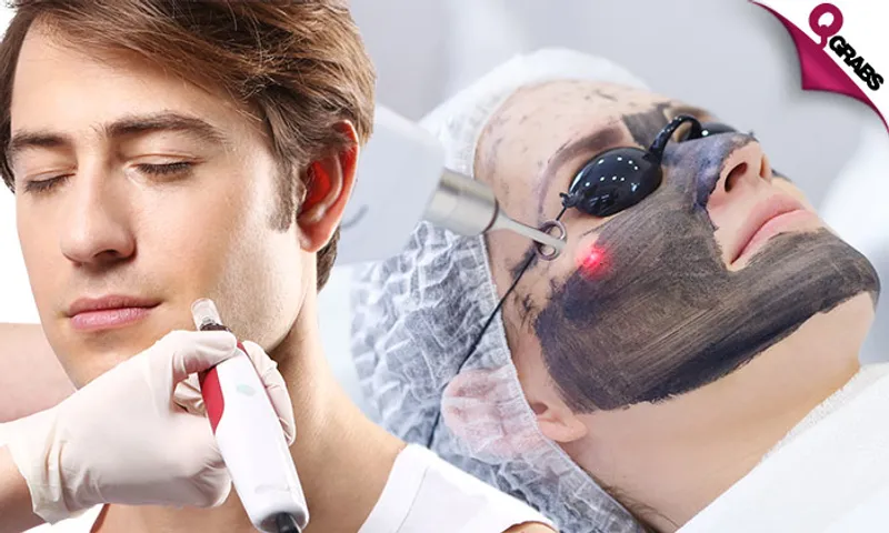 Carbon Peel, Micro-Needling RF, Derma Pen Mesotherapy & More!
